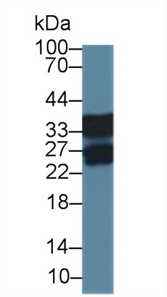 12740