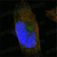 Валидация IF - AntibodySystem RHN90801