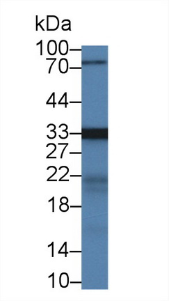 14326