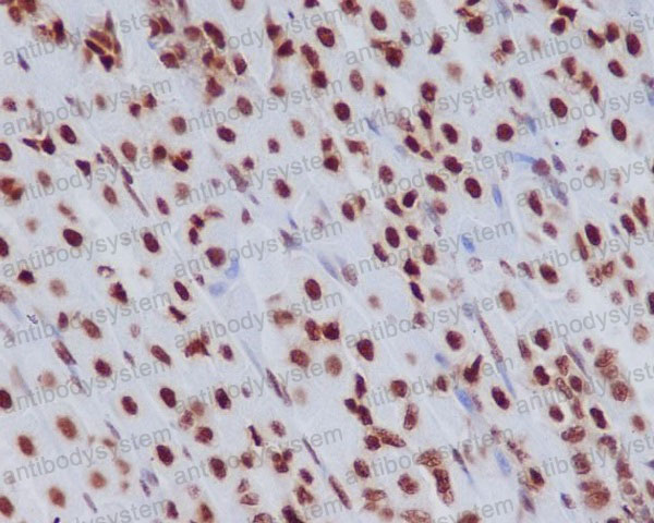 Валидация AntibodySystem RHF76502