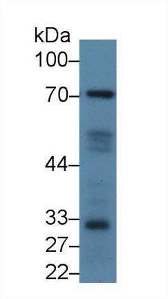 12474