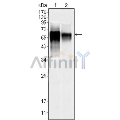 Валидация Affinity BF0640 - 5339