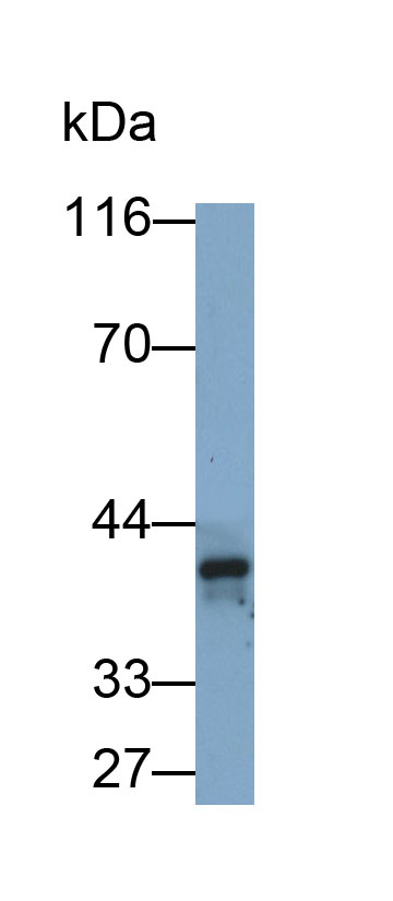 30855