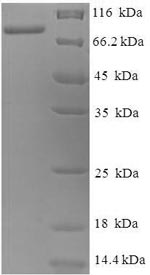 SDS-PAGE