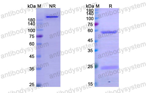 Валидация SDS-PAGE - AntibodySystem DHD85404