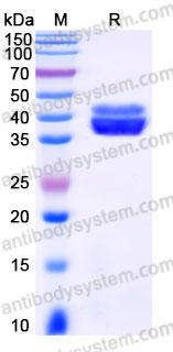 EHC22301, SDS-PAGE