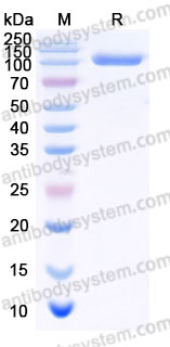 AHD52901, SDS-PAGE