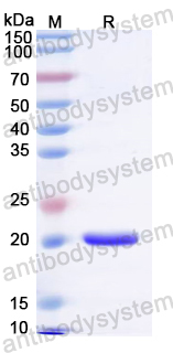 YVV35701, SDS-PAGE