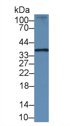 14044