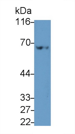 55524