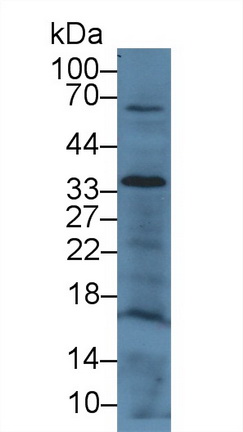 14728