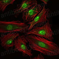 Валидация IF - AntibodySystem RHD15905