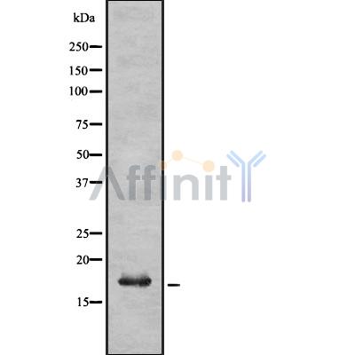 Валидация Affinity DF8152 - 20004