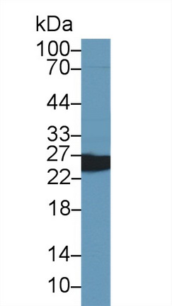 14526