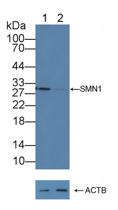 12296