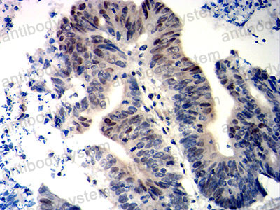 Валидация AntibodySystem RHD34804 (1516)