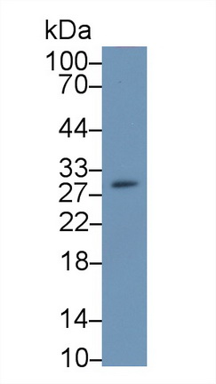 17606