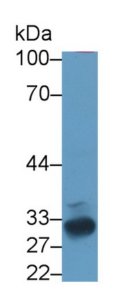 11375