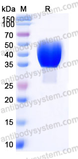 EHJ63002, SDS-PAGE