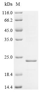 SDS-PAGE