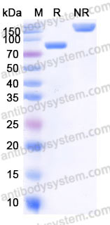 AHD10801, SDS-PAGE