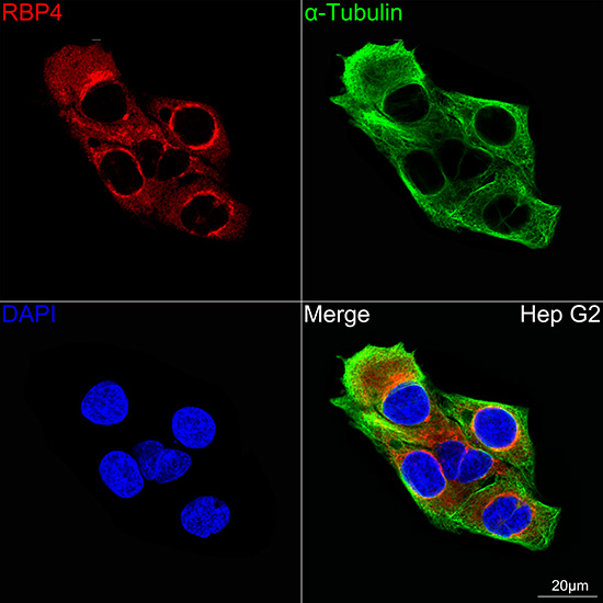 A28000, конфокальная микроскопия, клетки Hep G2 (16621)