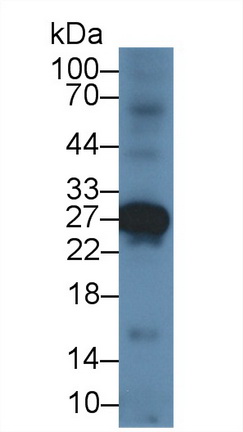 14726
