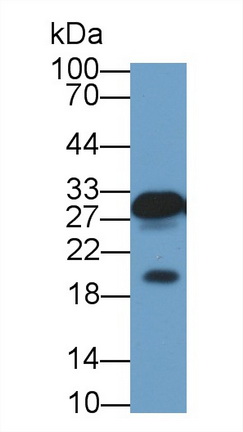 13642