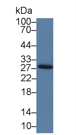 14283