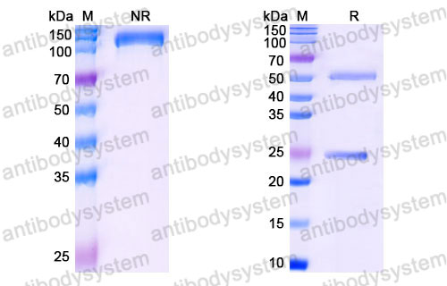 Валидация SDS-PAGE - AntibodySystem FRJ92810