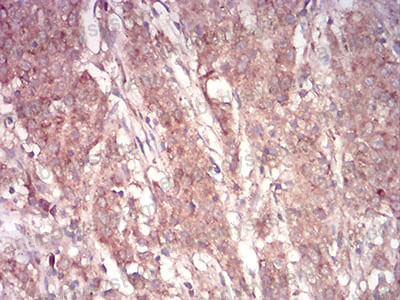 Валидация AntibodySystem RHF75702