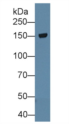 8641