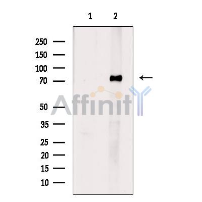 Валидация Affinity DF8278 - 20124