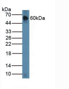 6399