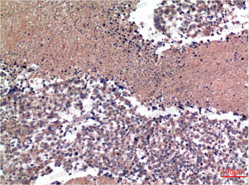 Валидация AntibodySystem RHD05705 (1298)