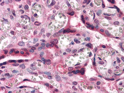 Валидация AntibodySystem RHE07606