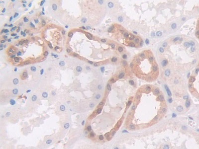 25731