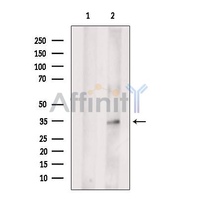 Валидация Affinity DF6357 - 17707