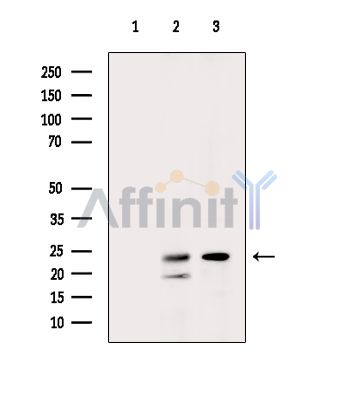 Валидация Affinity DF15201 - 11469