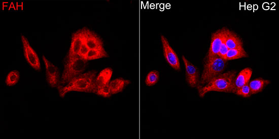 A6586, иммунофлуоресценция, клетки HepG2 (17919)