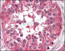Валидация AntibodySystem RHD08206