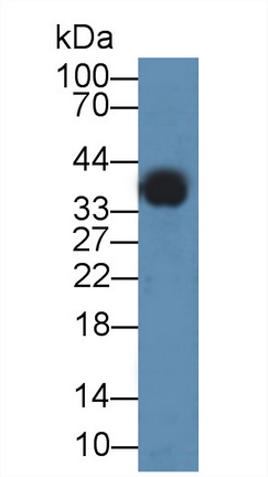 12356