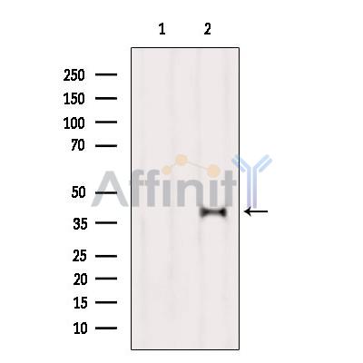 Валидация Affinity DF10256 - 5850