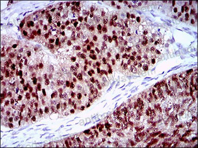 Валидация AntibodySystem RHN08502