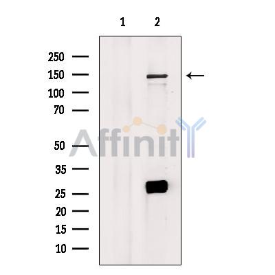 Валидация Affinity DF8842 - 20919