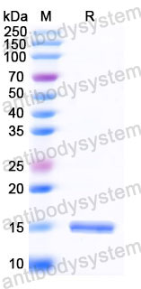 Валидация SDS-PAGE - AntibodySystem RHJ84501
