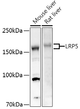 A0130, вестерн-блоттинг, различные лизаты (78)
