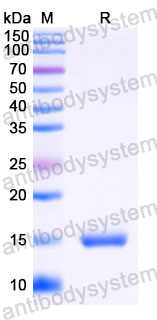 Валидация SDS-PAGE - AntibodySystem RVV23701