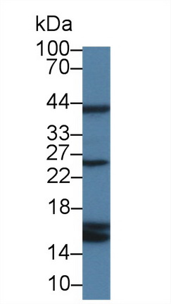 14310
