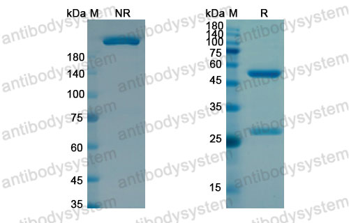 Валидация SDS-PAGE - AntibodySystem DHF90701
